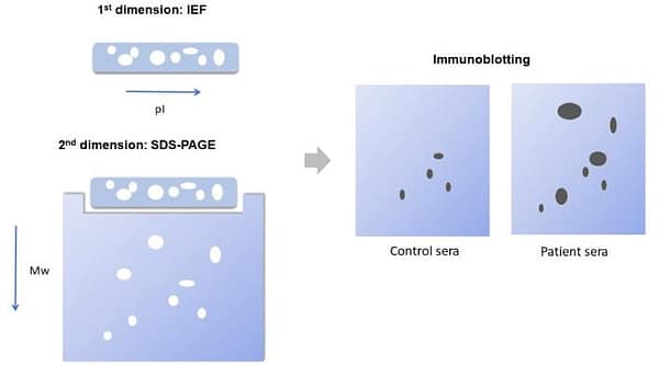 2D SDS-PAGE